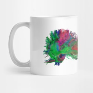 Brain fibres side view right, DTI scan (C038/4665) Mug